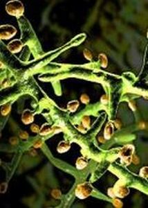Fungus below the microscope