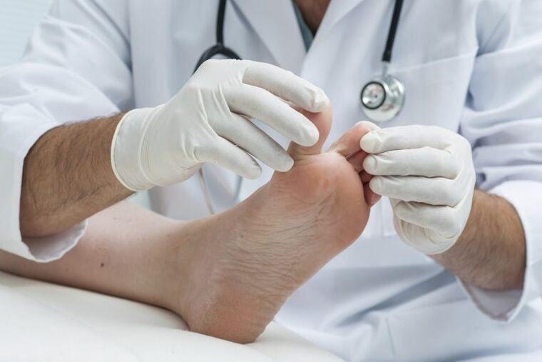 An overview of the doctor's presence of mycosis