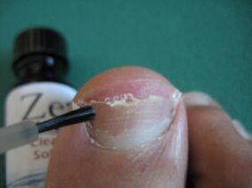 Application of varnish