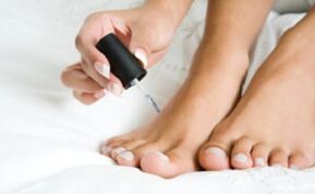 Lacquer treatment