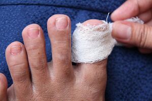 Sick nail